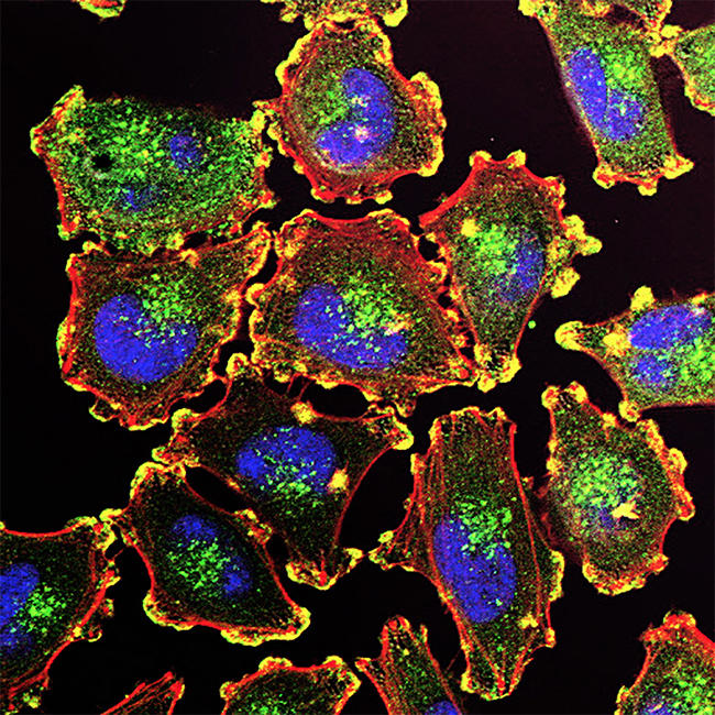 Advances in Melanoma and Other Skin Cancers Research